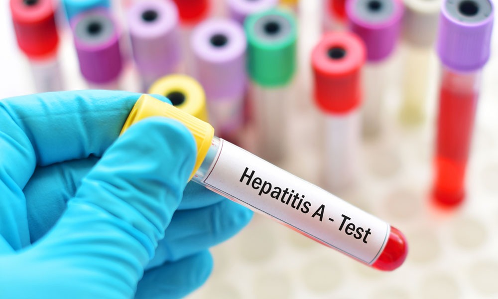 The Dangers of Hepatitis A