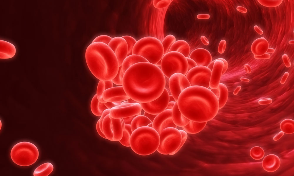 The Risks and Dangers of Bloodclots